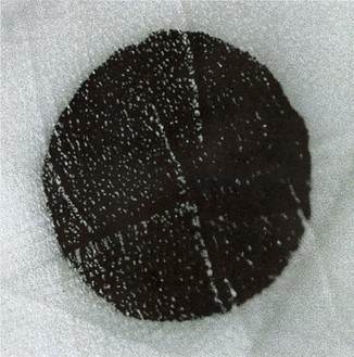 Douglas Gordon, Black Spot, 2000 Digital C-type print, 29 ½ × 29 ½ inches (74.9 × 74.9 cm), edition of 13
