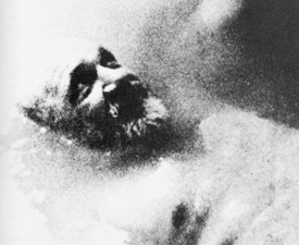 Black and white close up image of a person lying down, their face surrounded by a fog of film grain